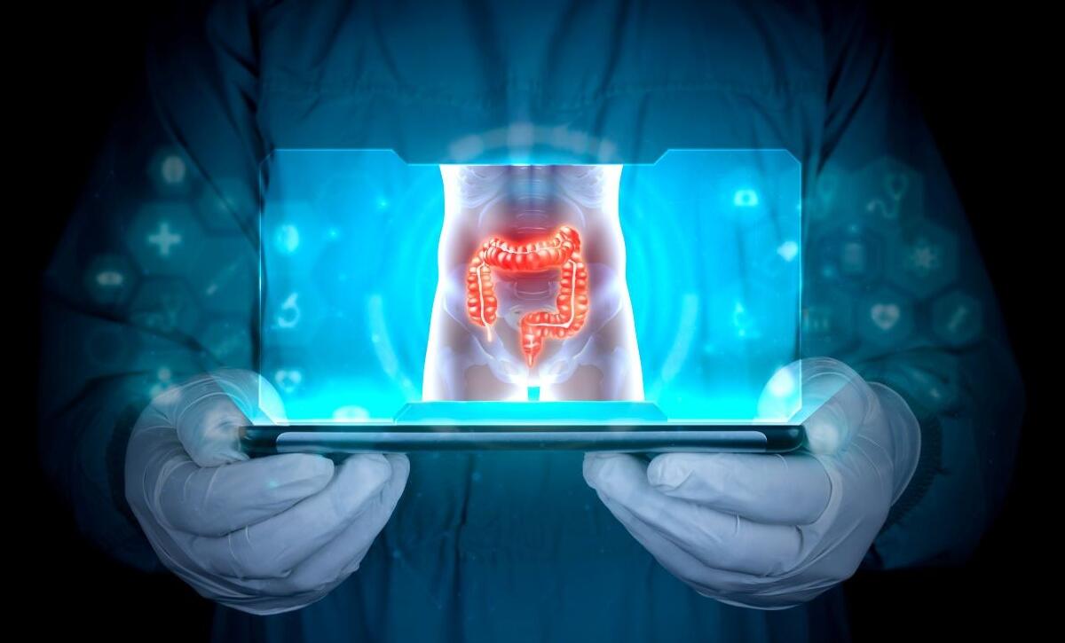 diverticoli cosa sono e sintomi
