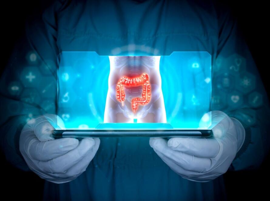 diverticoli cosa sono e sintomi