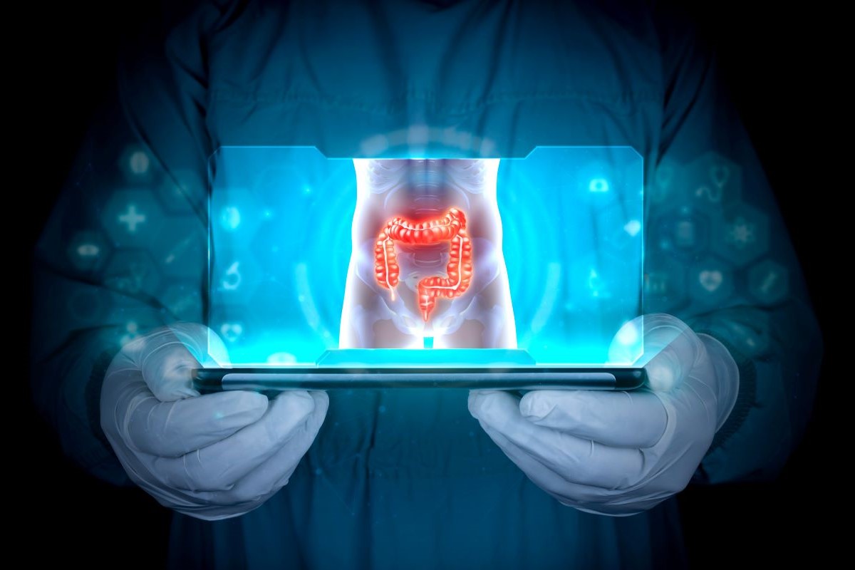 diverticoli cosa sono e sintomi