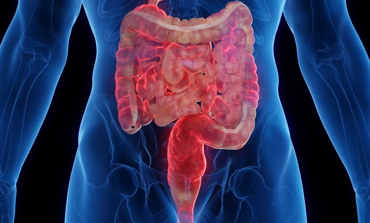 quali sono i sintomi del morbo di crohn