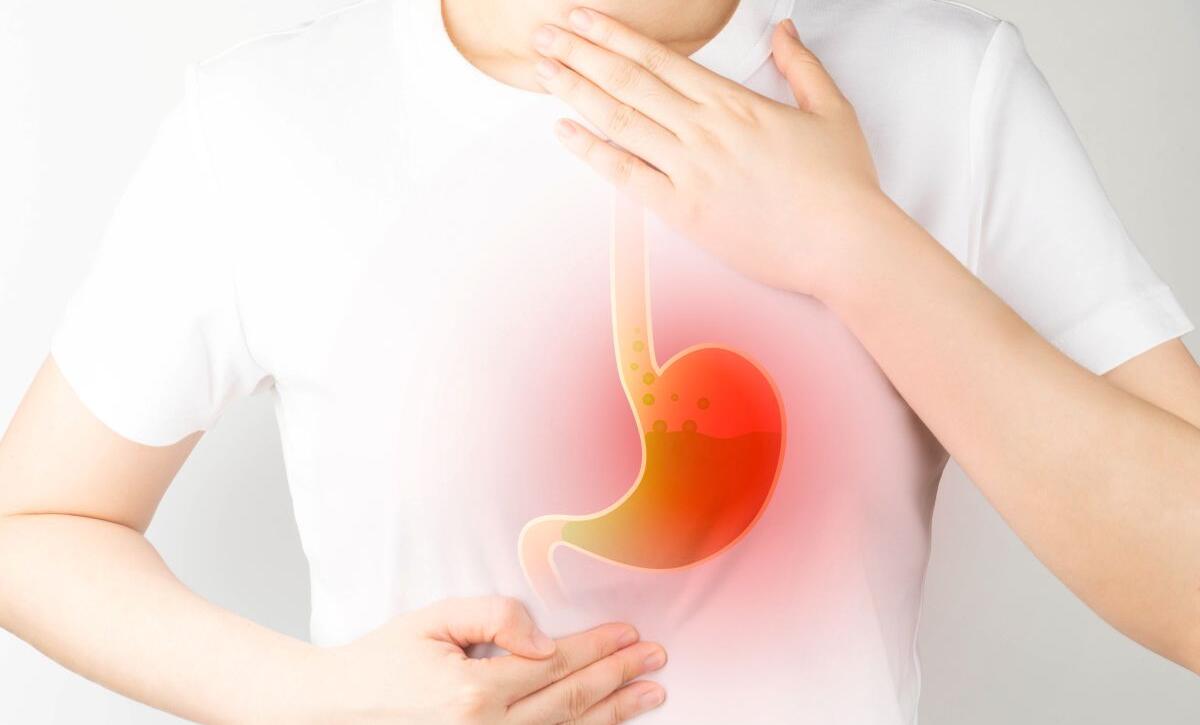 reflusso gastroesofageo intervento chirurgico