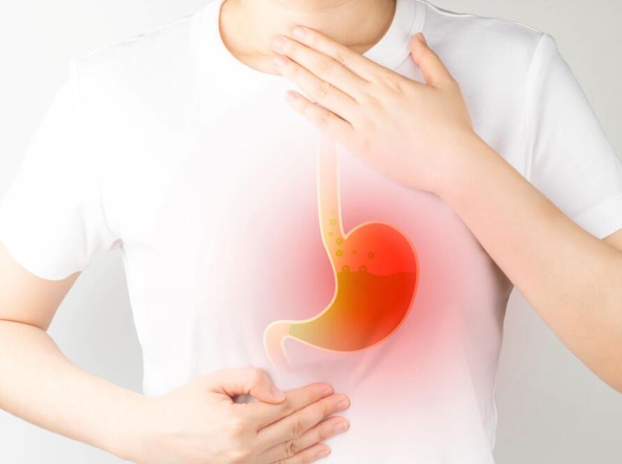 reflusso gastroesofageo intervento chirurgico