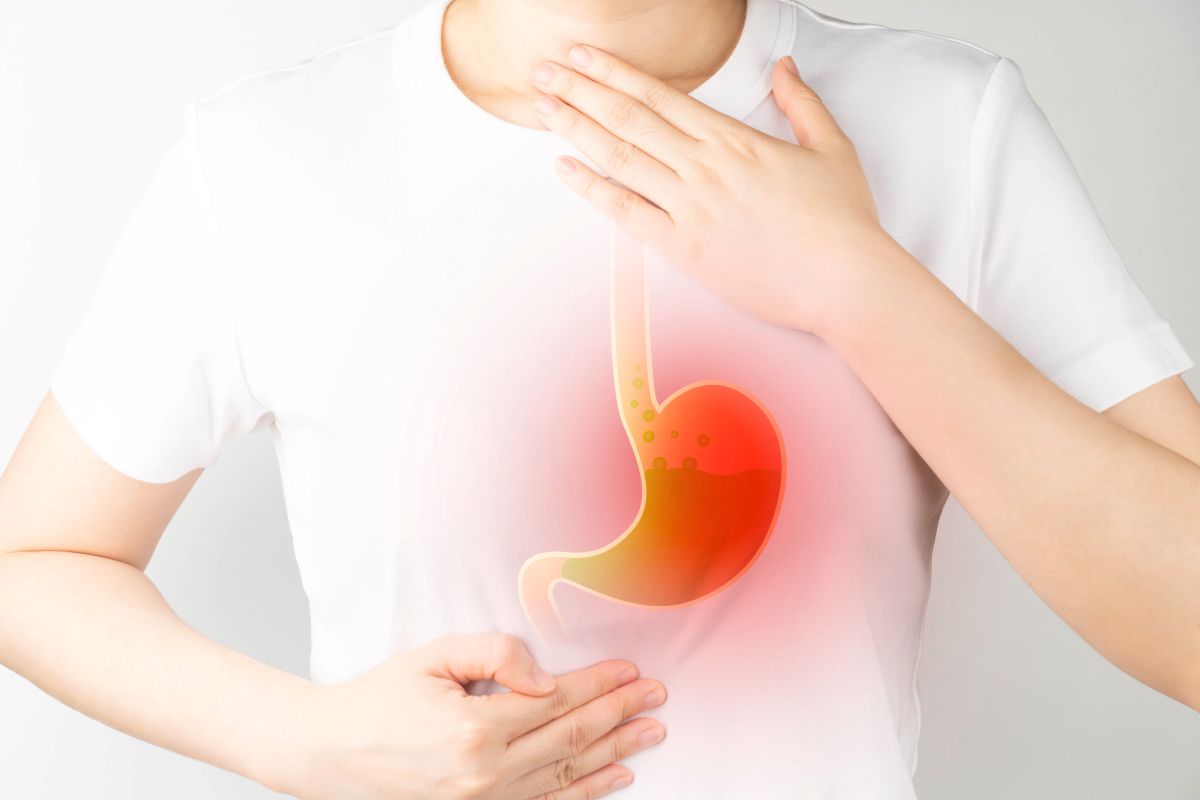 reflusso gastroesofageo intervento chirurgico