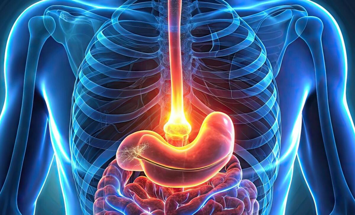 intervento acalasia esofagea
