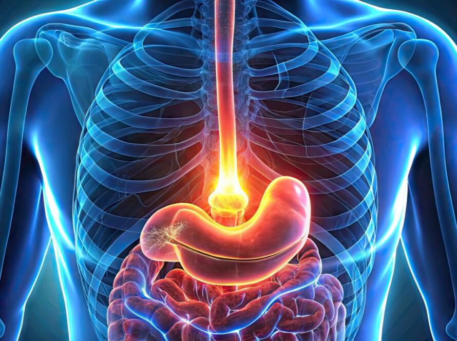 intervento acalasia esofagea