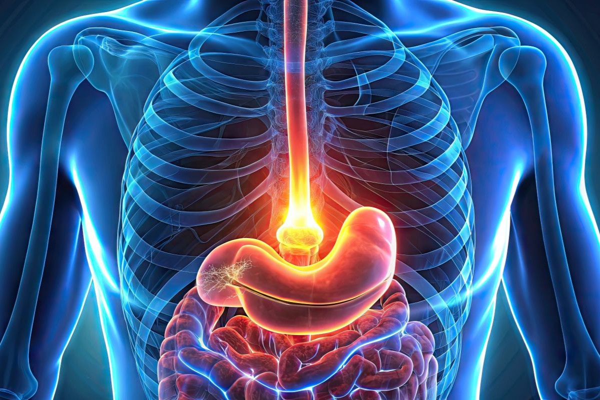 intervento acalasia esofagea