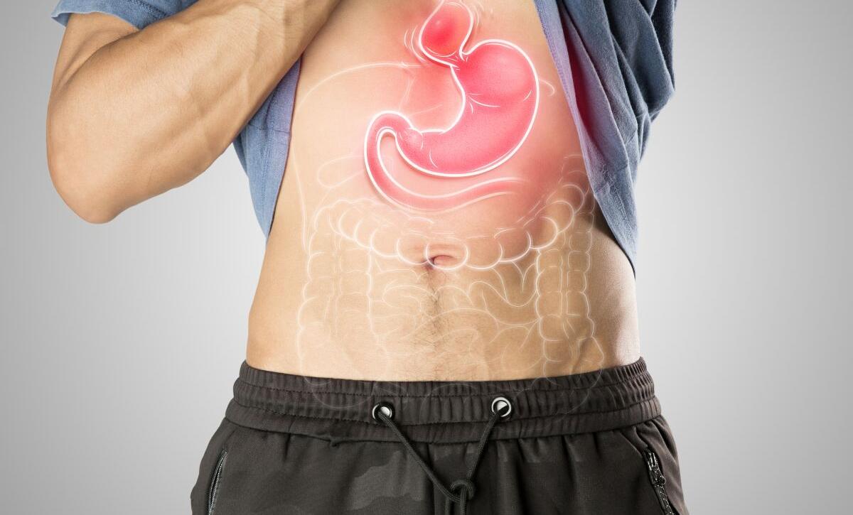 sintomi ernia iatale