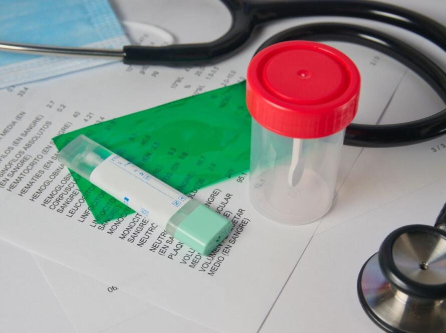 screening sangue occulto