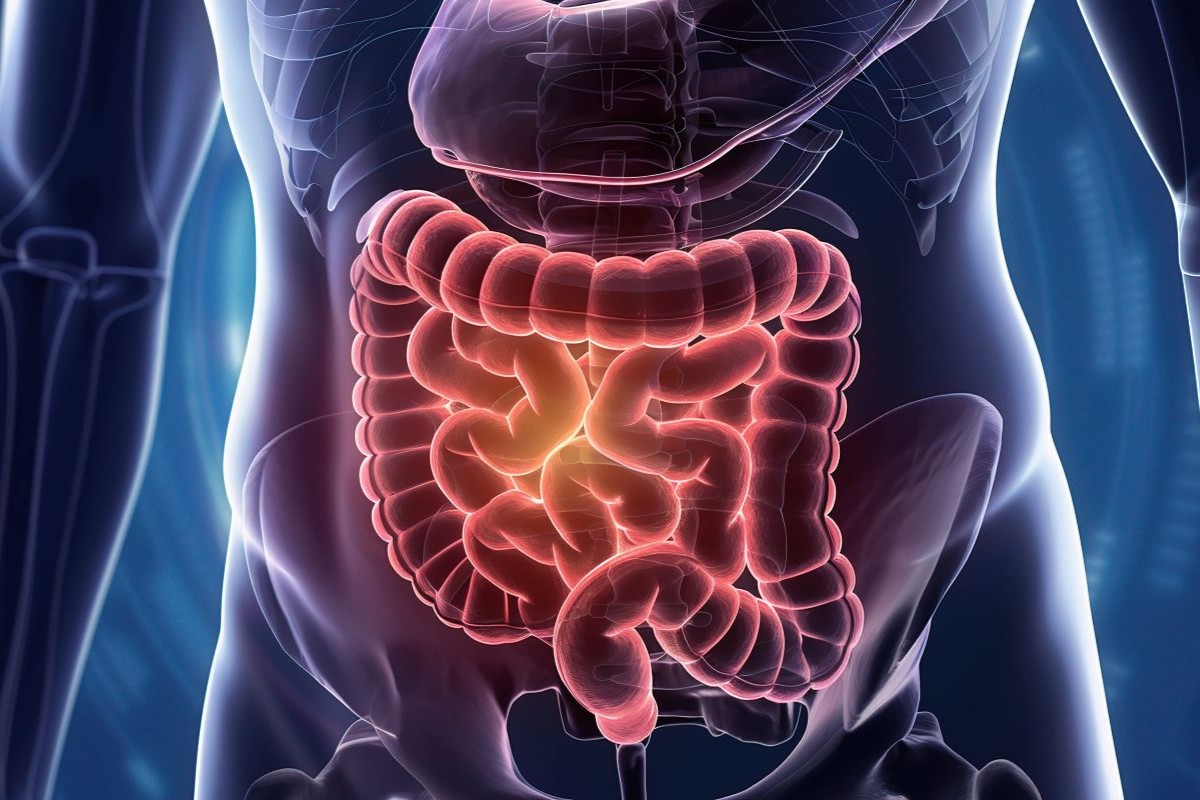 quando sospettare occlusione intestinale